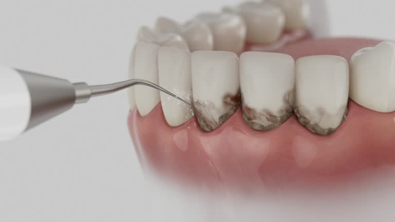 Trusted Emergency Dentist service in Fremont, MI - Dentist Open Now